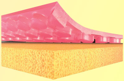 Le proc�d� TENSOR